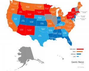 Gastric sleeve prices by state.
