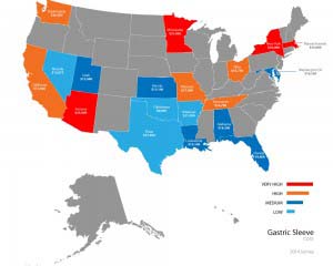 Map of US showing gastric sleeve prices.