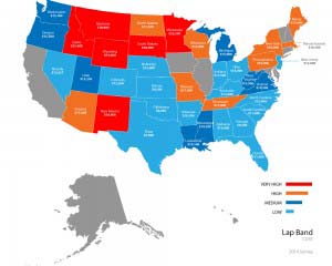 Lap Band prices by state.