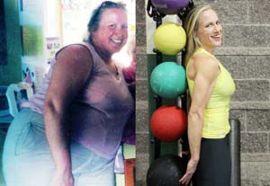 Gastric bypass before and after pic of Robanne