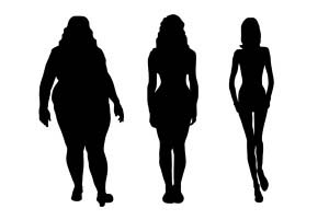 In the shadows - do you tell people you had weight loss surgery?