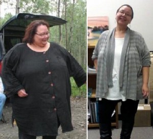 Ingrid's before and after bariatric surgery pictures.