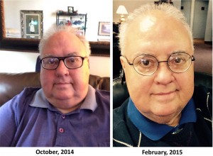 Walter - before and after gastric sleeve.