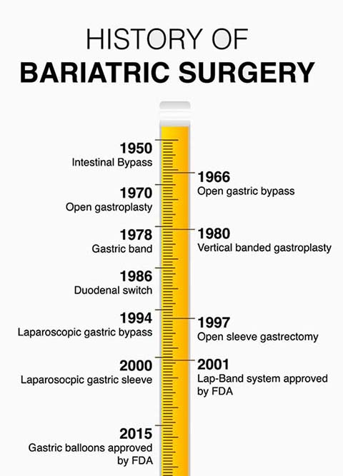 History of Bariatric Surgery Timeline  Obesity Coverage