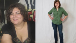 Before and after gastric bypass