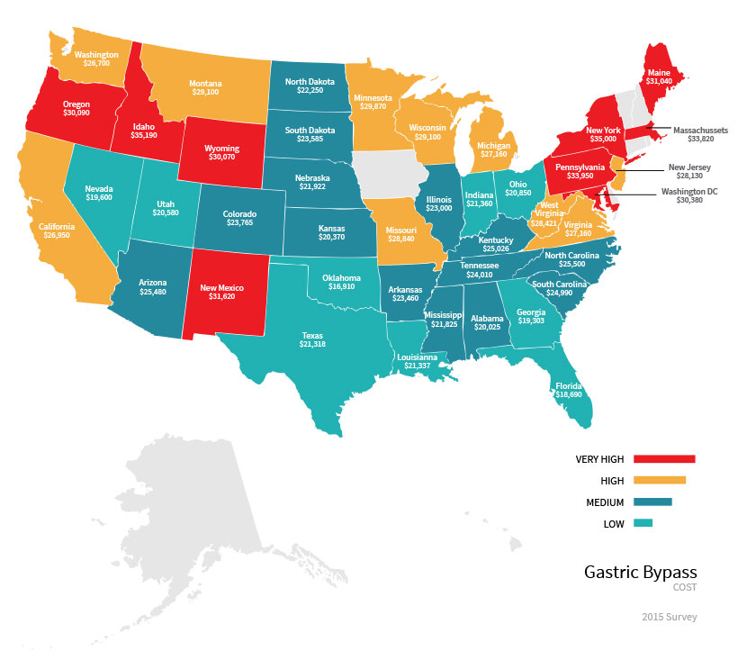 Prices for gastric bypass across the United States.