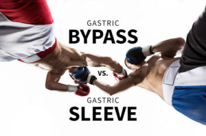 Gasrtic bypass vs. gastric Sleeve