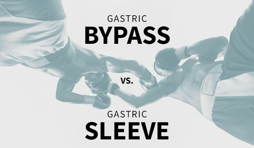 Gastric Bypass vs sleeve surgery