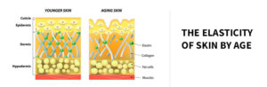 The elasticity of skin by age