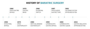 Bariatric surgery timeline.