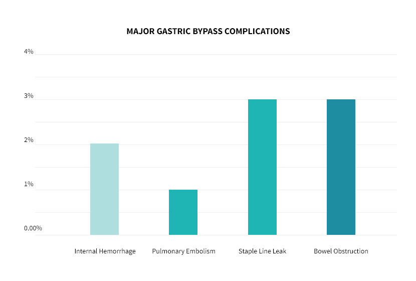 Major complications chart after gastric bypass surgery. 