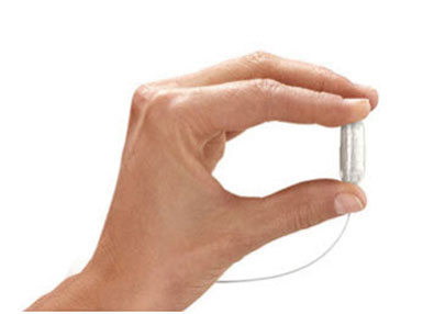 Orbera gastric balloon pill.